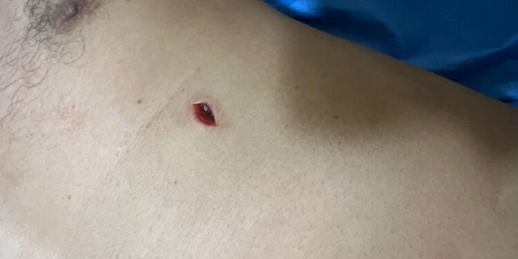 Korban penganiayaan, Muhammad Syafe’i (54) caleg urut lima PKS, daerah pemilihan satu Banteng.