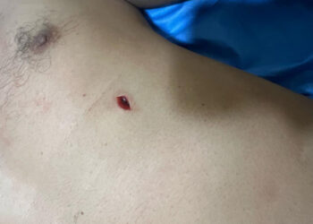 Korban penganiayaan, Muhammad Syafe’i (54) caleg urut lima PKS, daerah pemilihan satu Banteng.